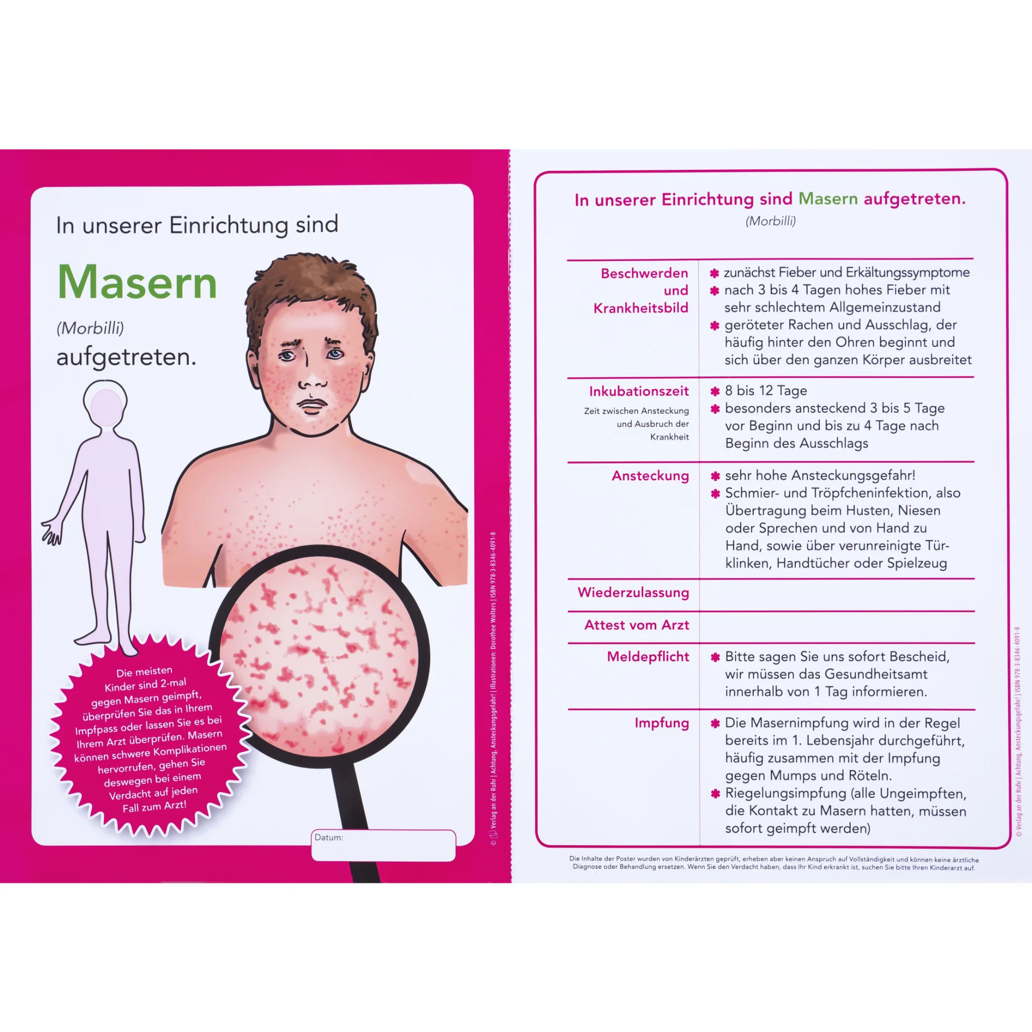 Masern, Kinderkrankheit, Hautausschlag, Infektionskrankheit, Impfung