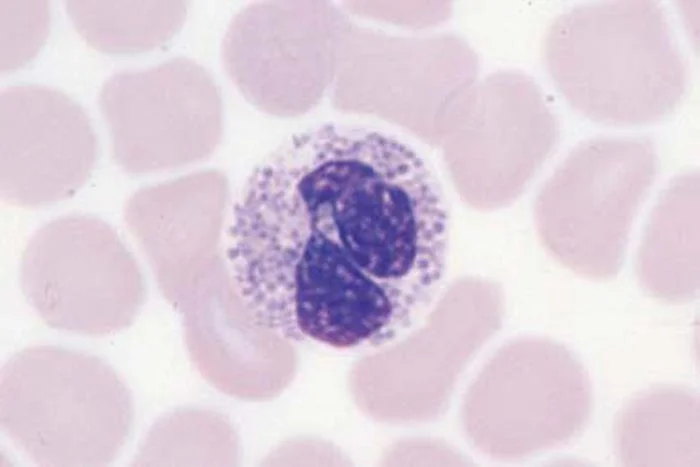 blutbild, zellkern, bläschen, mikroskopisch, medizinisch