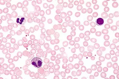 Blutkörperchen, rote Blutkörperchen, Thrombozyten, weiße Blutkörperchen, Blutausstrich