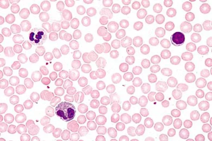 Blutkörperchen, rote Blutkörperchen, Thrombozyten, weiße Blutkörperchen, Blutausstrich