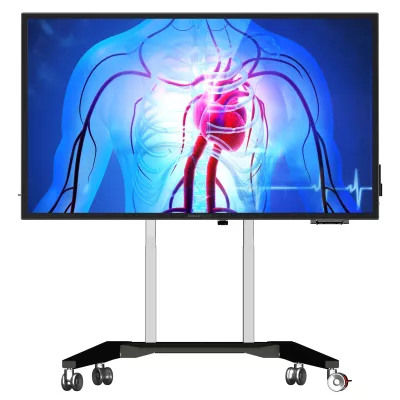 Monitor, medizinischer Bildschirm, digitale Anzeige, Rollständer, HD-Display