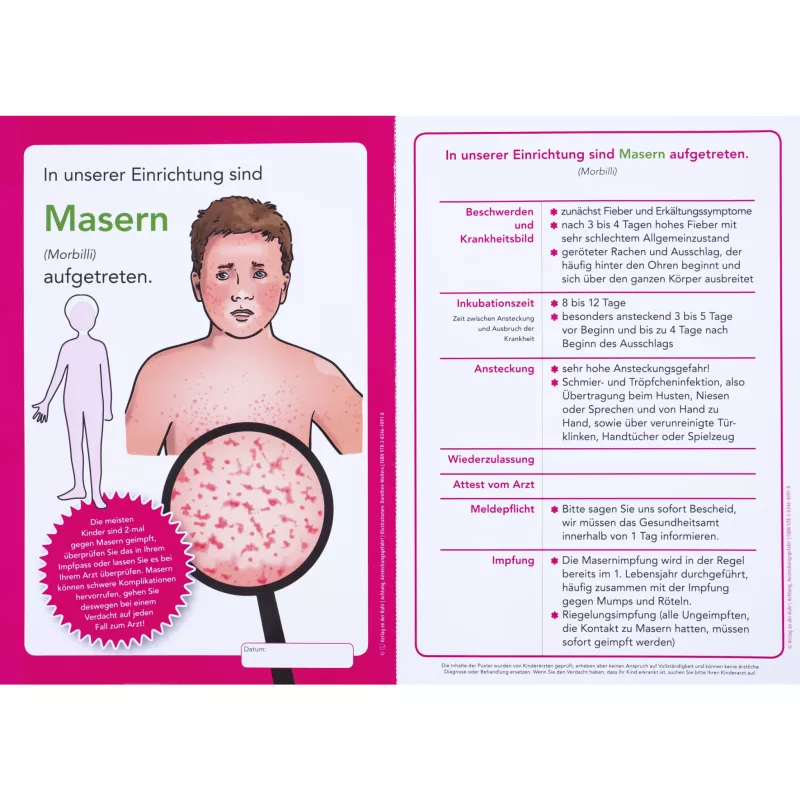 Masern, Kinderkrankheit, Hautausschlag, Infektionskrankheit, Impfung
