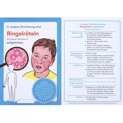 Ringelröteln, Infektionskrankheit, Kinderarzt, Infoblatt, Häufige Symptome