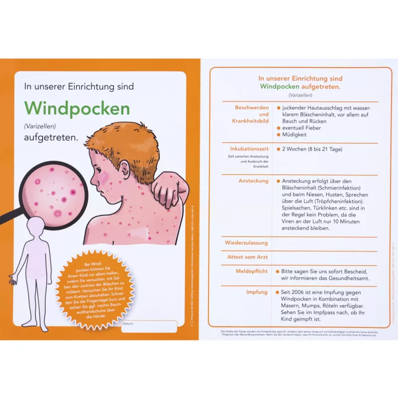 Windpocken, Aufgeplatzte Haut, Infektion, Infektionsanzeige, Kinderkrankheit