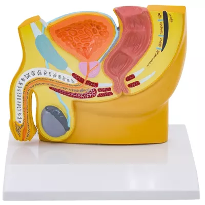 medizinisches Modell, Anatomie, Harnorgane, Prostata, Schaubild