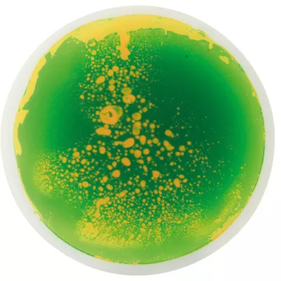 Petri-Schale, Agarwachstum, Grün Gelb, Bakterienkultur, Mikrobiologie